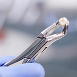 TOOTH EXTRACTION